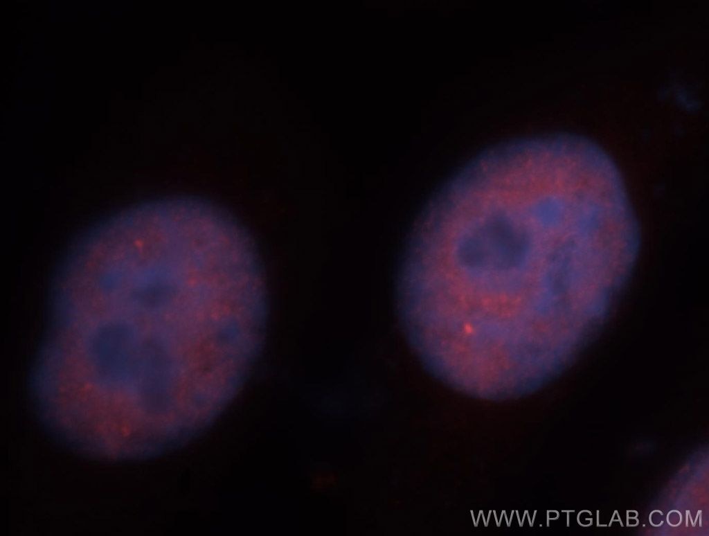Immunofluorescence (IF) / fluorescent staining of HeLa cells using IRF2BP1 Polyclonal antibody (13698-1-AP)