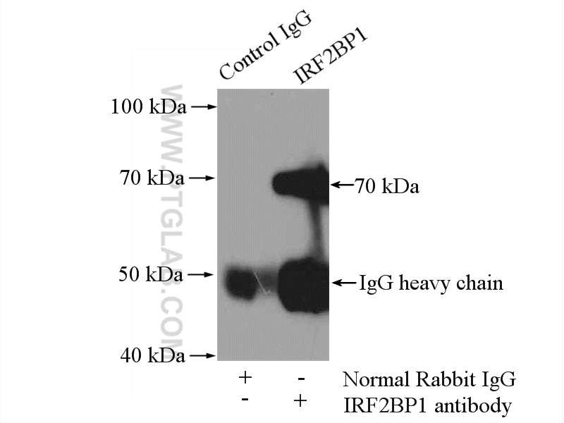 IP experiment of HEK-293 using 13698-1-AP