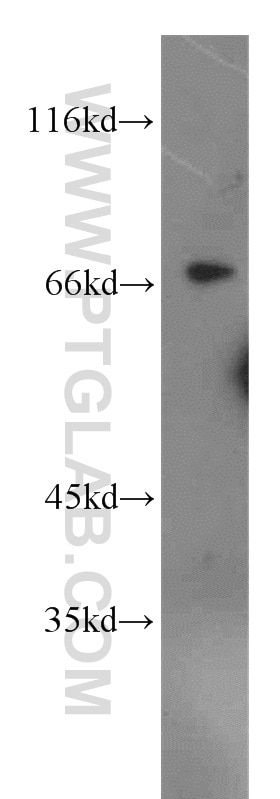 Western Blot (WB) analysis of mouse brain tissue using IRF2BP1 Polyclonal antibody (13698-1-AP)