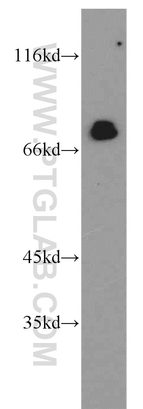 Western Blot (WB) analysis of Jurkat cells using IRF2BP1 Polyclonal antibody (13698-1-AP)