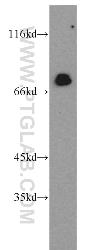 WB analysis of Jurkat using 13698-1-AP