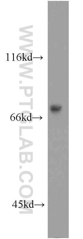Western Blot (WB) analysis of rat lymph tissue using IRF2BP1 Polyclonal antibody (13698-1-AP)