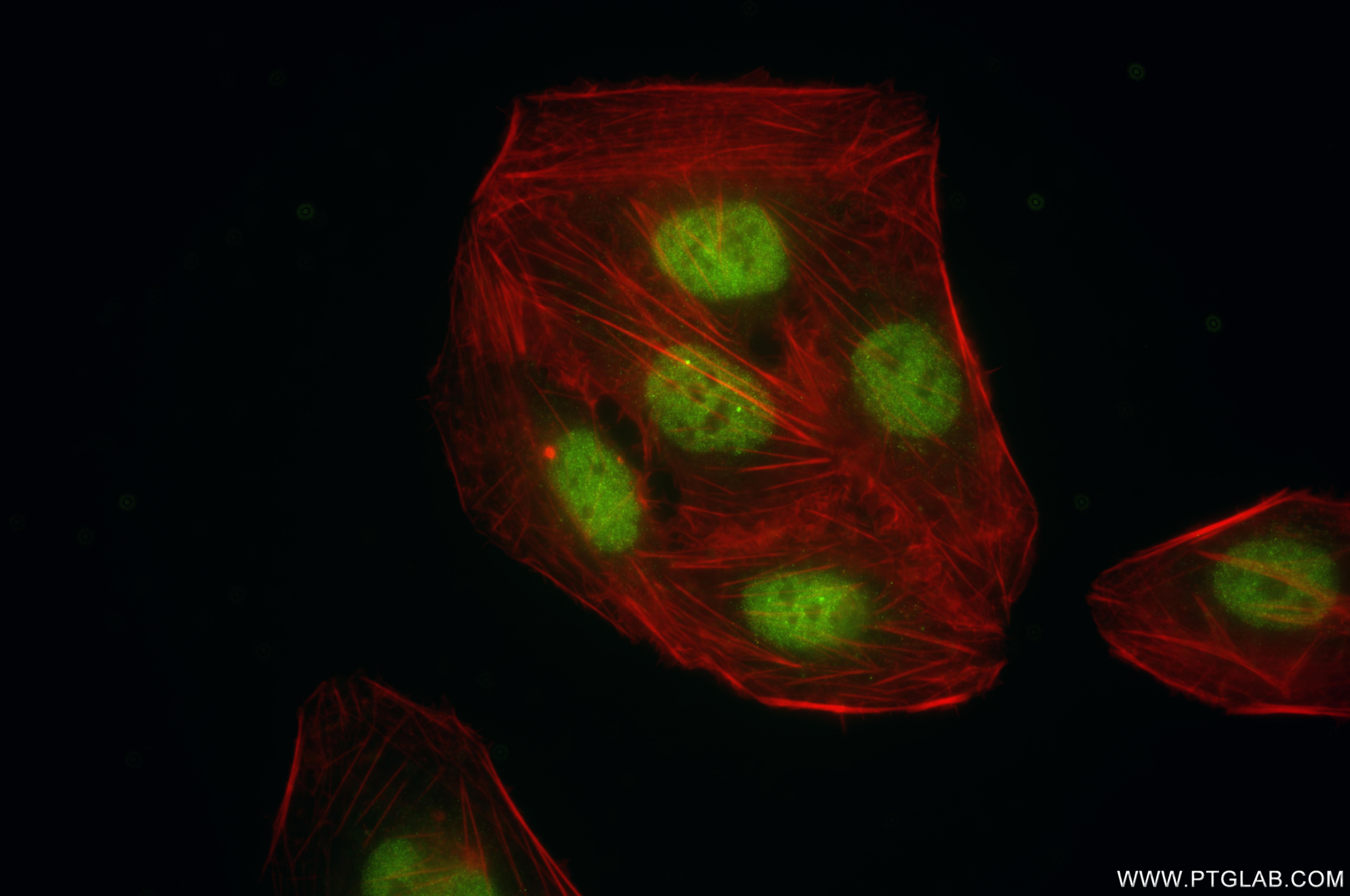Immunofluorescence (IF) / fluorescent staining of U2OS cells using IRF2BP1 Recombinant antibody (86048-1-RR)