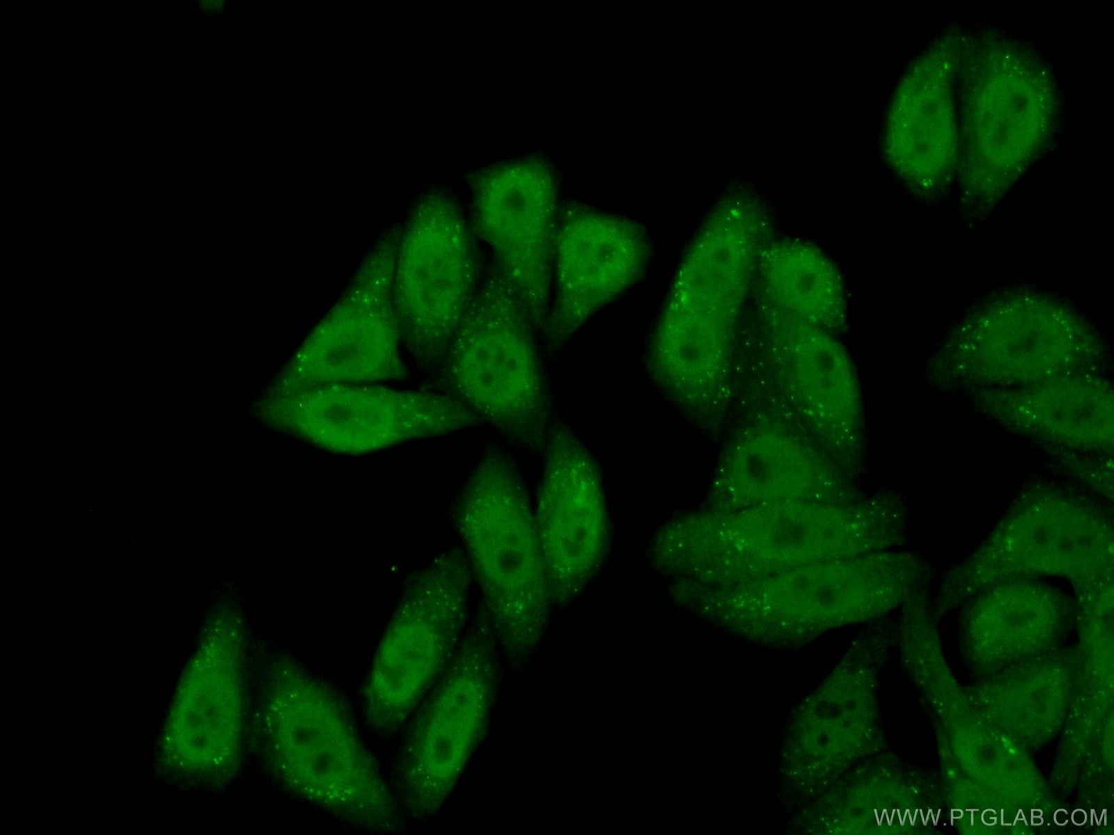 Immunofluorescence (IF) / fluorescent staining of HepG2 cells using IRF2BP2 Polyclonal antibody (18847-1-AP)