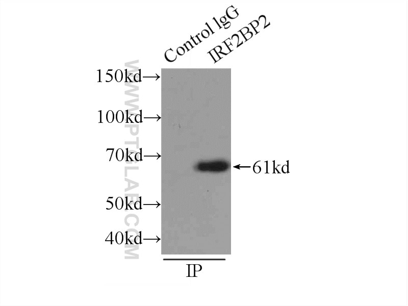 Immunoprecipitation (IP) experiment of K-562 cells using IRF2BP2 Polyclonal antibody (18847-1-AP)