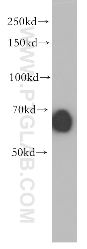 Western Blot (WB) analysis of Jurkat cells using IRF2BP2 Polyclonal antibody (18847-1-AP)