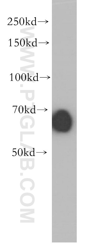 WB analysis of Jurkat using 18847-1-AP