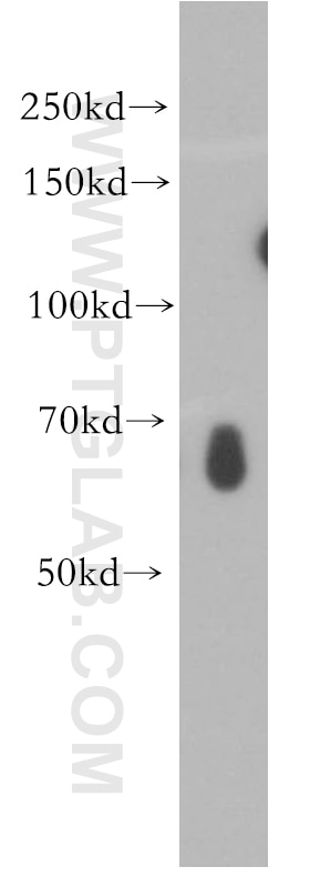 Western Blot (WB) analysis of HepG2 cells using IRF2BP2 Polyclonal antibody (18847-1-AP)