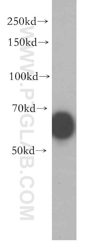 Western Blot (WB) analysis of K-562 cells using IRF2BP2 Polyclonal antibody (18847-1-AP)