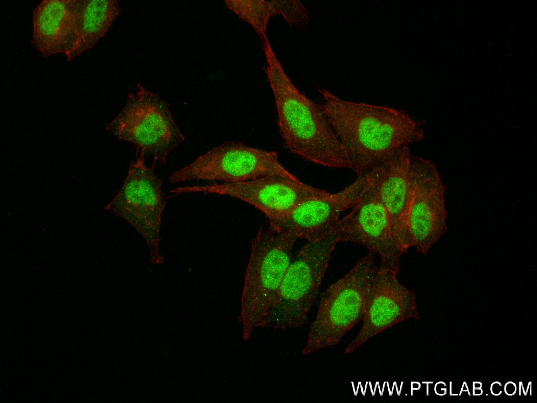 Immunofluorescence (IF) / fluorescent staining of HepG2 cells using IRF2BP2 Recombinant antibody (84750-1-RR)