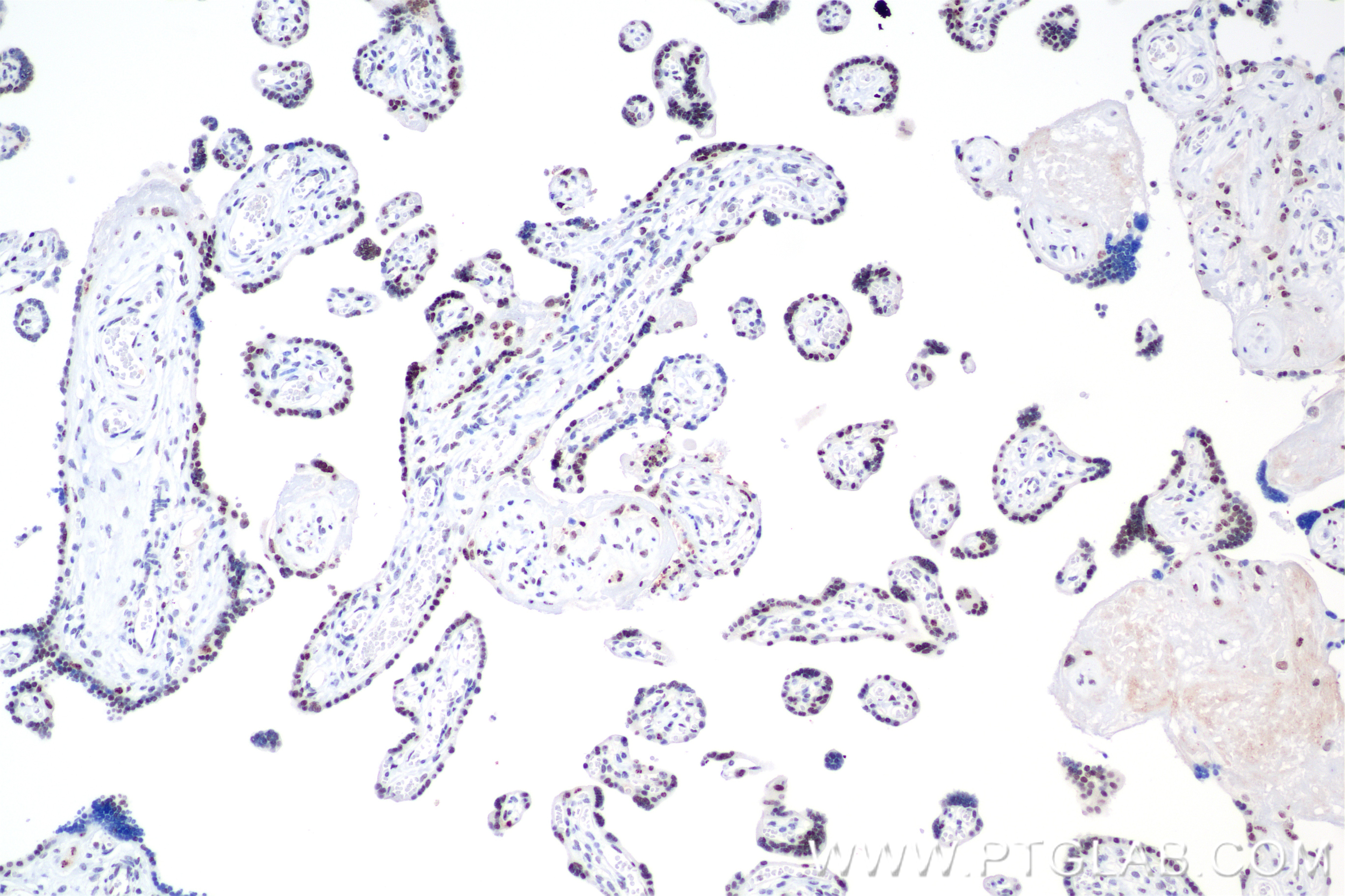Immunohistochemical analysis of paraffin-embedded human placenta tissue slide using 84750-1-RR (IRF2BP2 antibody) at dilution of 1:1000 (under 10x lens). Heat mediated antigen retrieval with Tris-EDTA buffer (pH 9.0). Immunohistochemistry (IHC) staining of human placenta tissue using IRF2BP2 Recombinant antibody (84750-1-RR)
