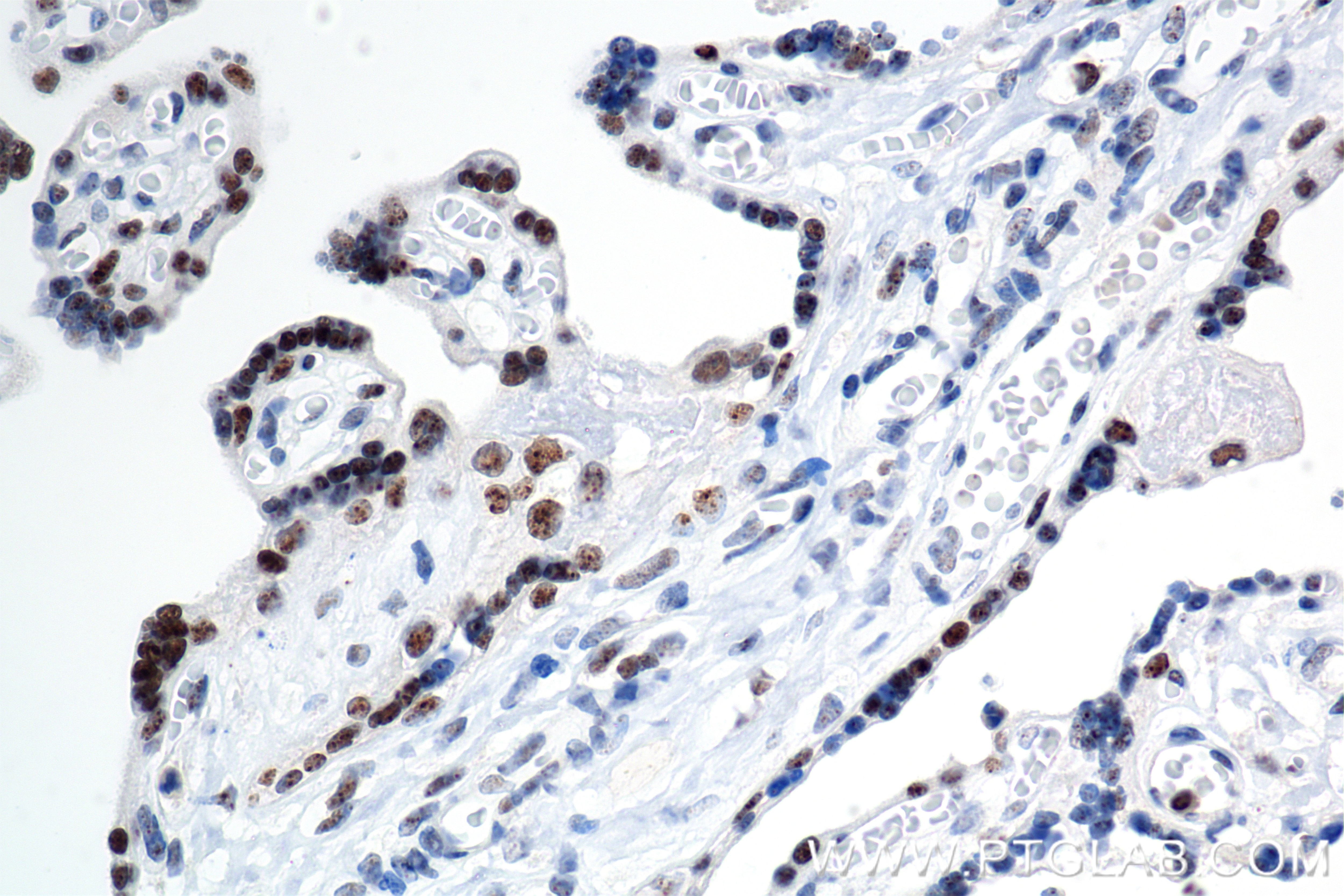 Immunohistochemical analysis of paraffin-embedded human placenta tissue slide using 84750-1-RR (IRF2BP2 antibody) at dilution of 1:1000 (under 40x lens). Heat mediated antigen retrieval with Tris-EDTA buffer (pH 9.0). Immunohistochemistry (IHC) staining of human placenta tissue using IRF2BP2 Recombinant antibody (84750-1-RR)