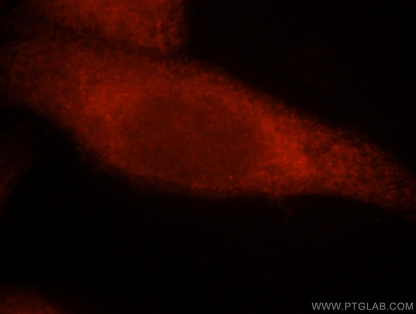Immunofluorescence (IF) / fluorescent staining of HepG2 cells using IRF3 Polyclonal antibody (11312-1-AP)
