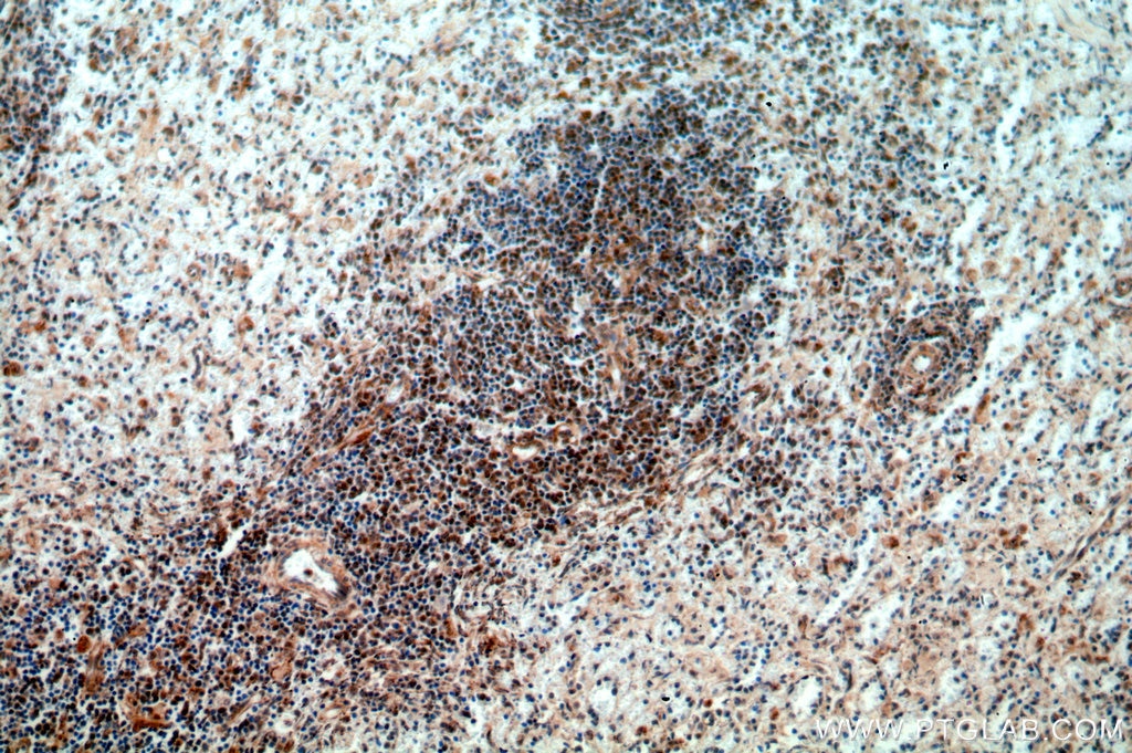 IHC staining of human spleen using 11312-1-AP