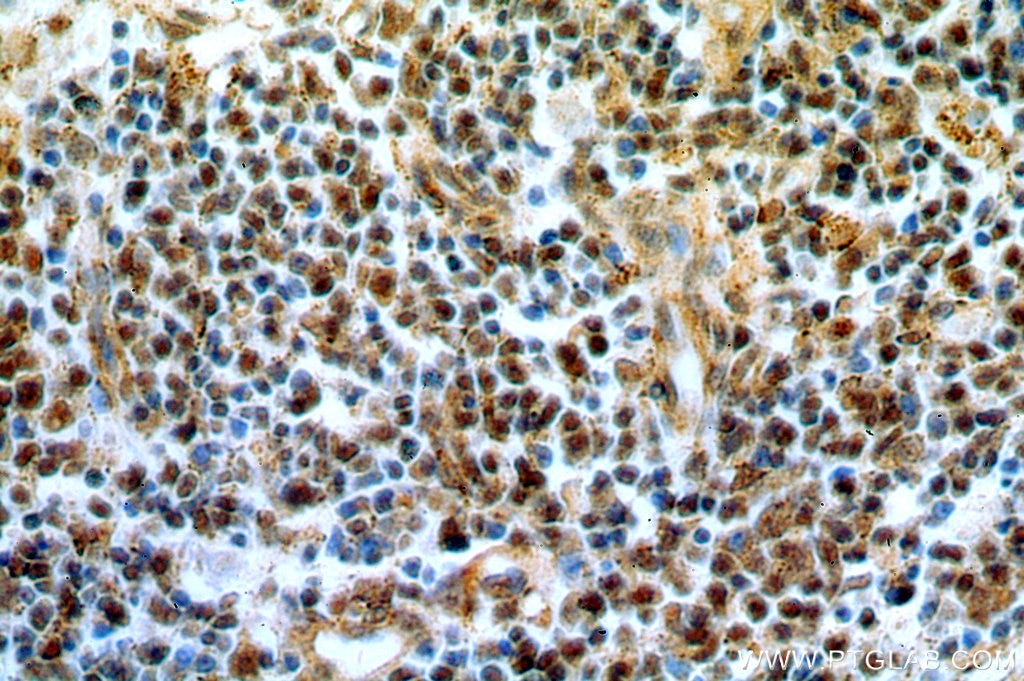 Immunohistochemistry (IHC) staining of human spleen tissue using IRF3 Polyclonal antibody (11312-1-AP)