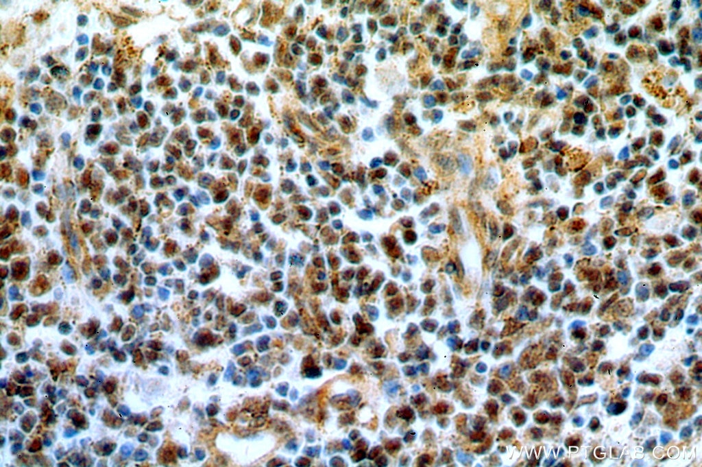 IHC staining of human spleen using 11312-1-AP