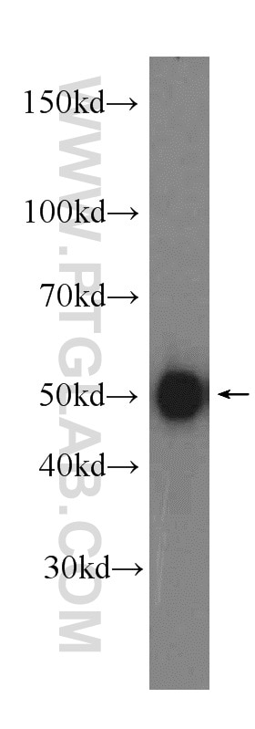 IRF3 Polyclonal antibody