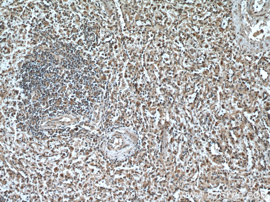Immunohistochemistry (IHC) staining of human spleen tissue using IRF3 Monoclonal antibody (66670-1-Ig)