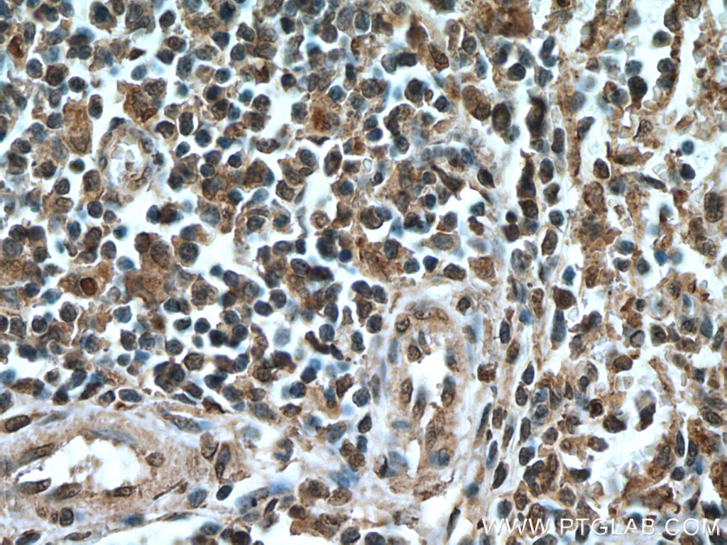 Immunohistochemistry (IHC) staining of human spleen tissue using IRF3 Monoclonal antibody (66670-1-Ig)