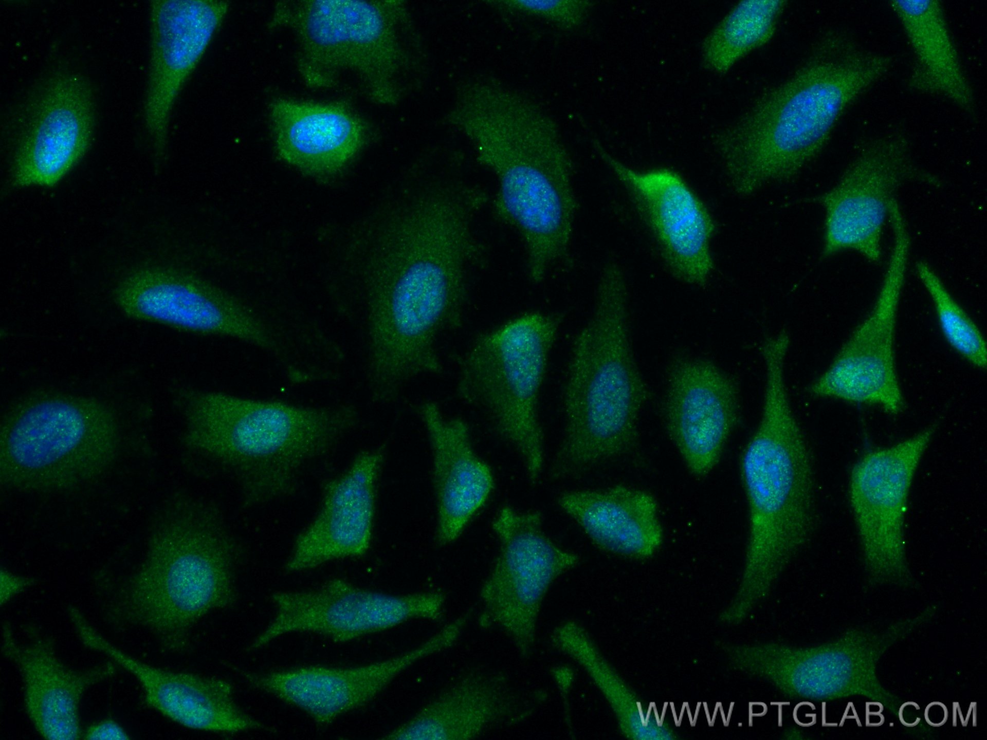 Immunofluorescence (IF) / fluorescent staining of HeLa cells using IRF3 Recombinant antibody (80519-1-RR)