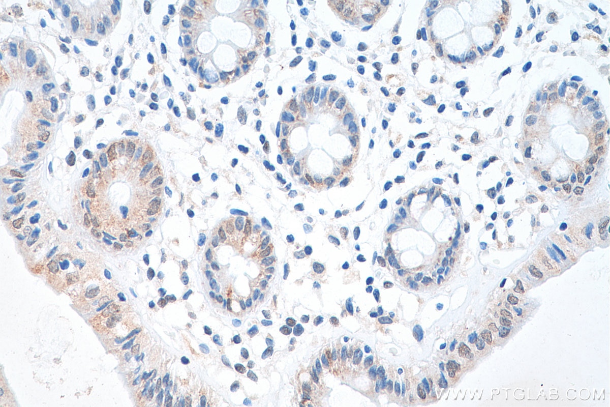 IHC staining of human colon using 80519-1-RR