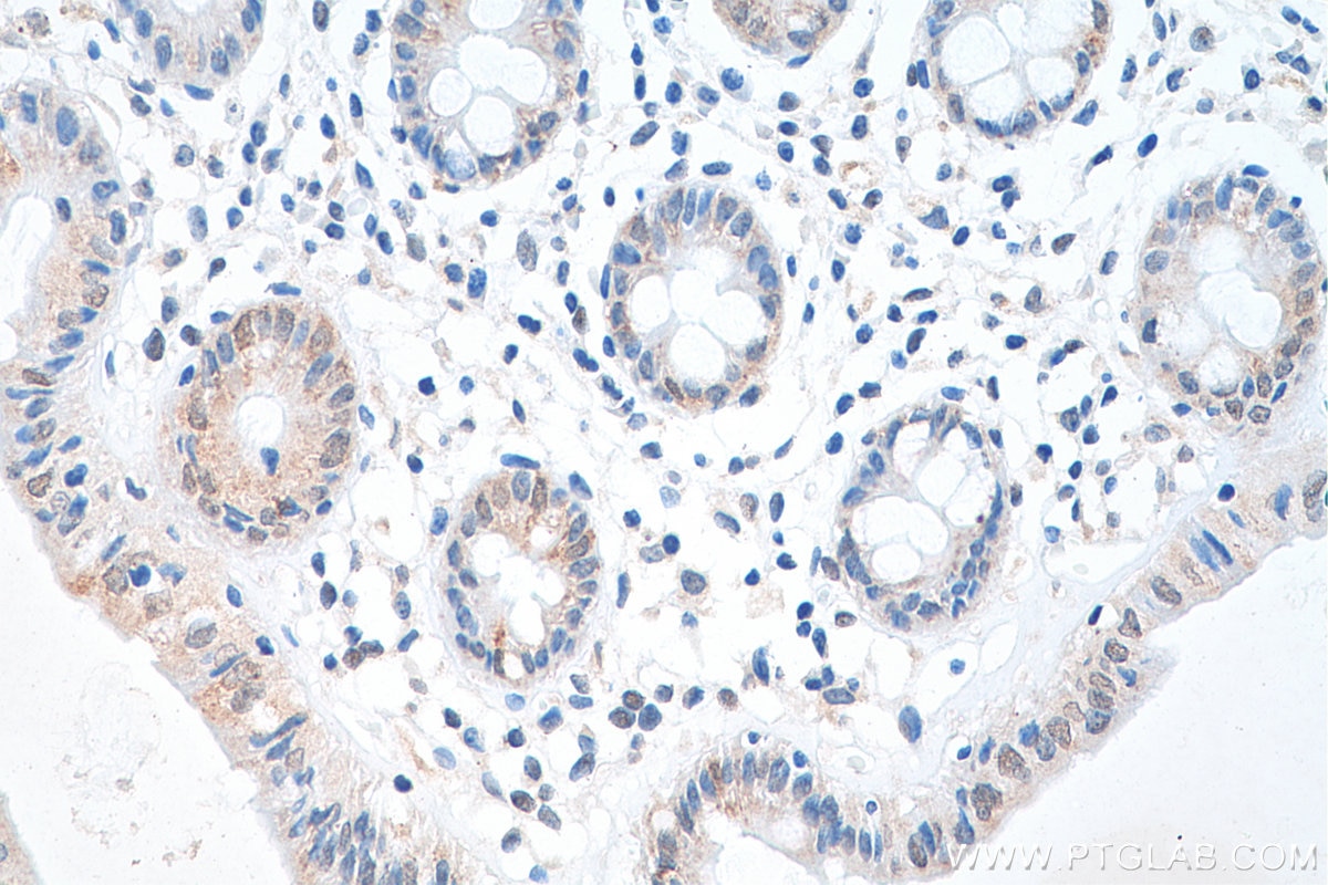 Immunohistochemistry (IHC) staining of human colon tissue using IRF3 Recombinant antibody (80519-1-RR)