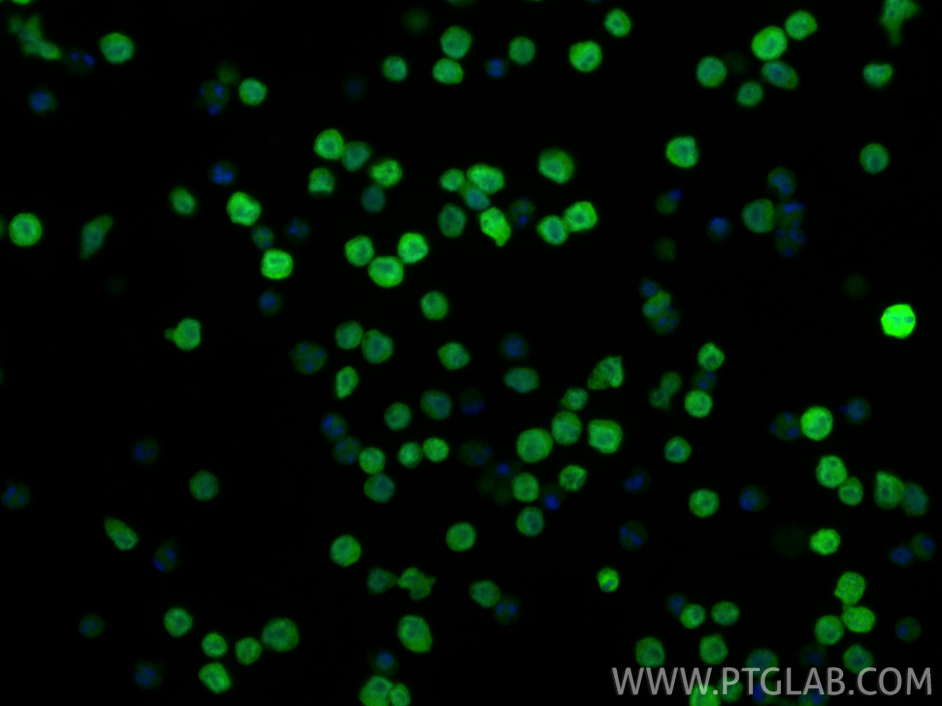 Immunofluorescence (IF) / fluorescent staining of Ramos cells using IRF4 Polyclonal antibody (11247-2-AP)