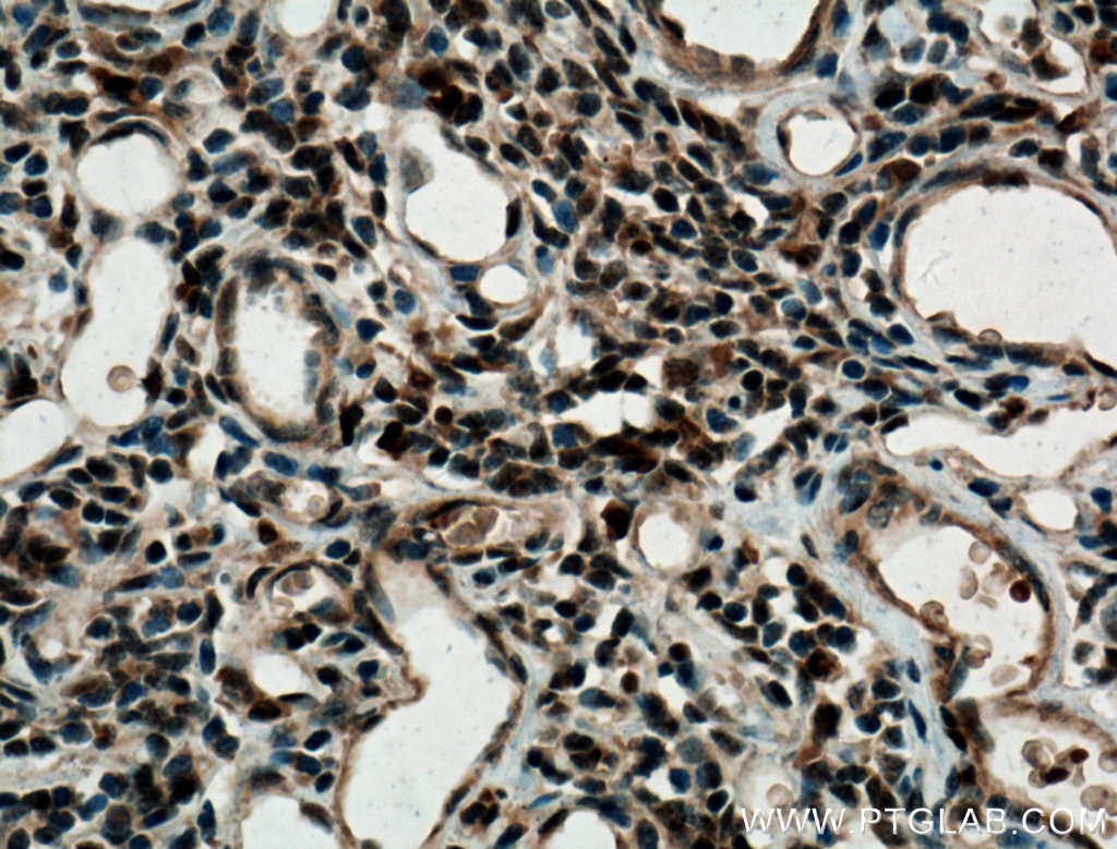 Immunohistochemistry (IHC) staining of human thymus tissue using MUM1/IRF4 Polyclonal antibody (11247-2-AP)