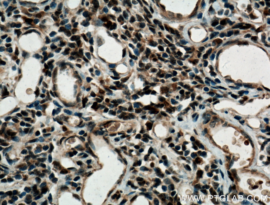 IHC staining of human thymus using 11247-2-AP