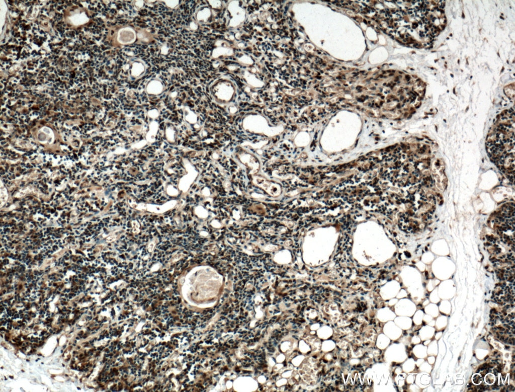 Immunohistochemistry (IHC) staining of human thymus tissue using MUM1/IRF4 Polyclonal antibody (11247-2-AP)