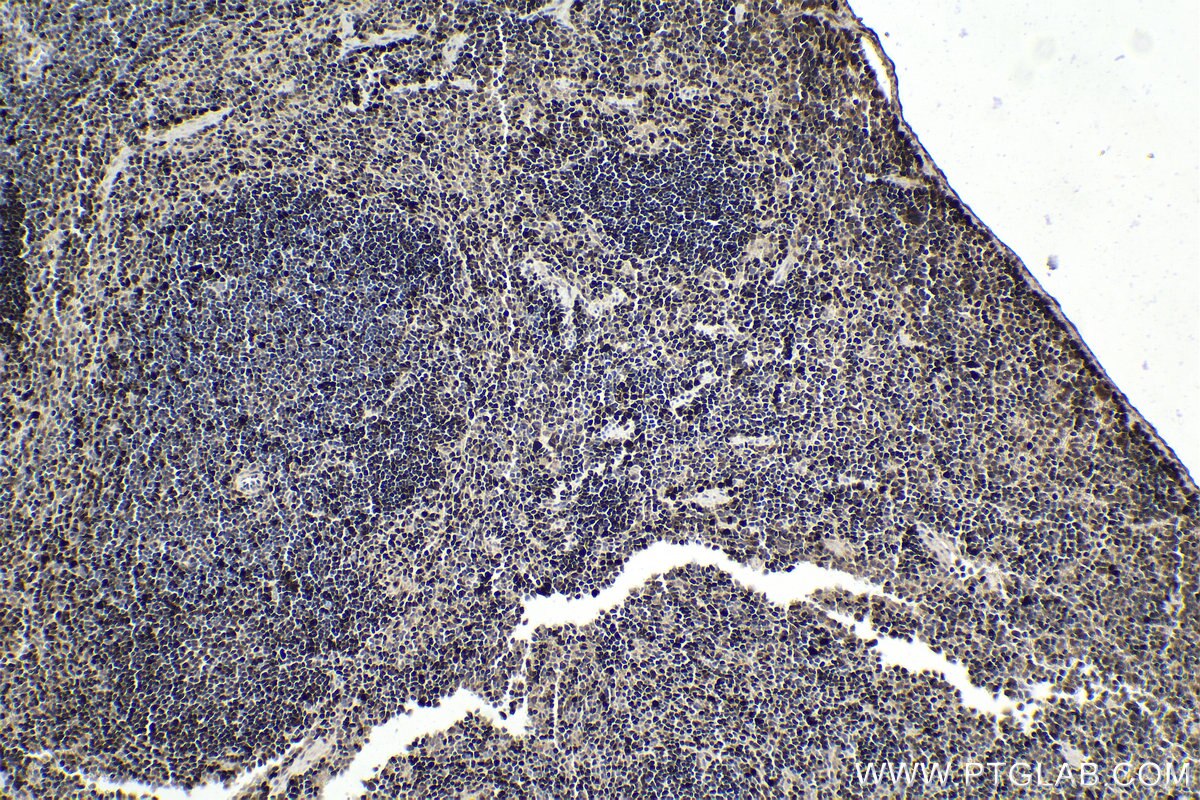 Immunohistochemistry (IHC) staining of mouse spleen tissue using MUM1/IRF4 Polyclonal antibody (11247-2-AP)