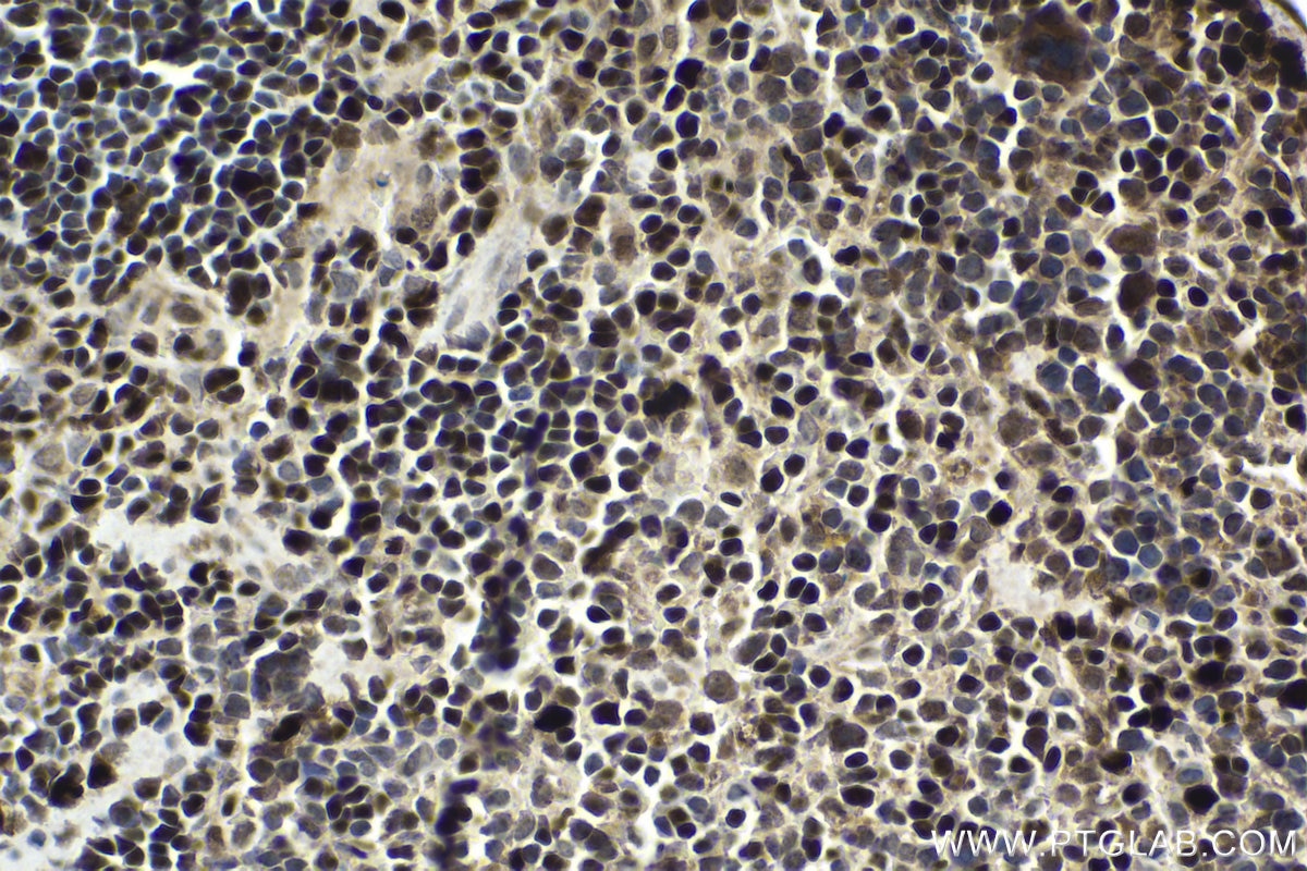 Immunohistochemistry (IHC) staining of mouse spleen tissue using MUM1/IRF4 Polyclonal antibody (11247-2-AP)