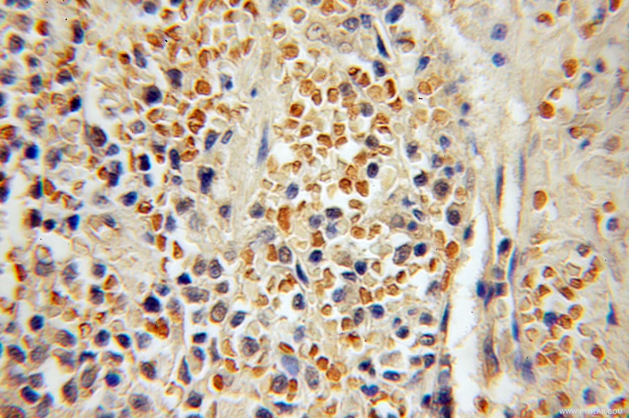 MUM1/IRF4 Polyclonal antibody