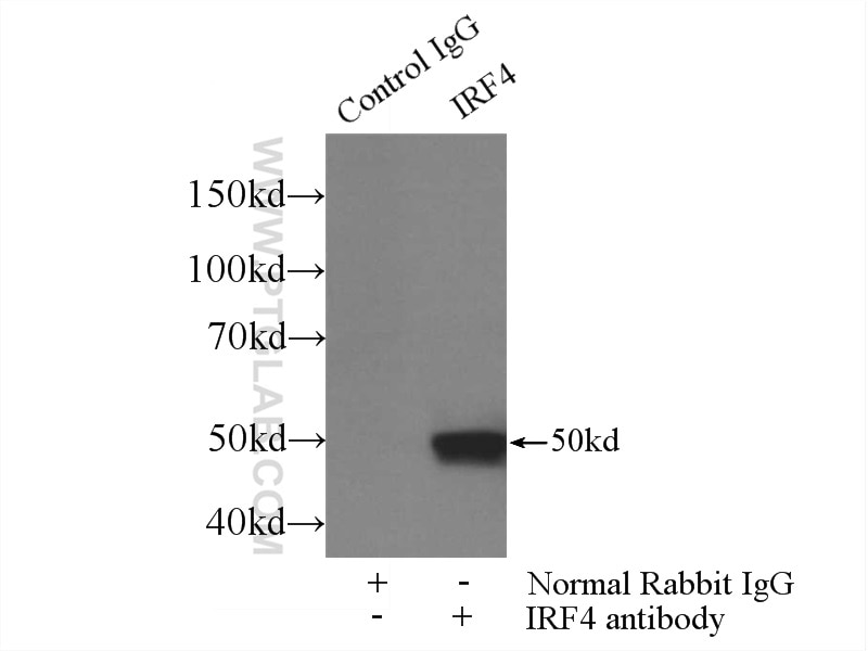 Immunoprecipitation (IP) experiment of mouse spleen tissue using MUM1/IRF4 Polyclonal antibody (11247-2-AP)
