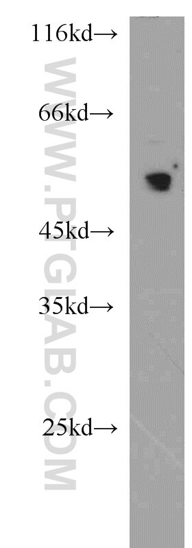 Western Blot (WB) analysis of Jurkat cells using MUM1/IRF4 Polyclonal antibody (11247-2-AP)