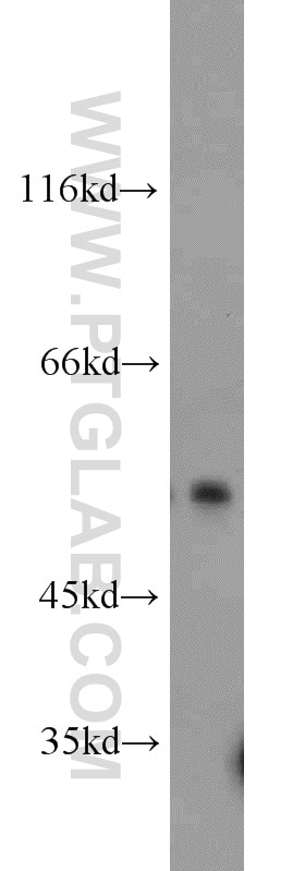 Western Blot (WB) analysis of mouse lung tissue using MUM1/IRF4 Polyclonal antibody (11247-2-AP)