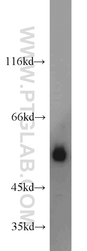 Western Blot (WB) analysis of Raji cells using MUM1/IRF4 Polyclonal antibody (11247-2-AP)