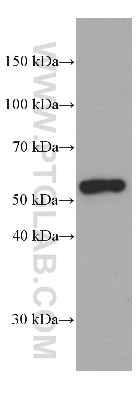 Western Blot (WB) analysis of pig spleen tissue using IRF4 Monoclonal antibody (66451-1-Ig)