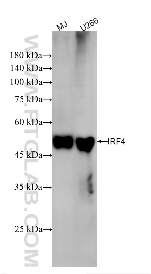 Western Blot (WB) analysis of various lysates using IRF4 Recombinant monoclonal antibody (87342-1-RR)