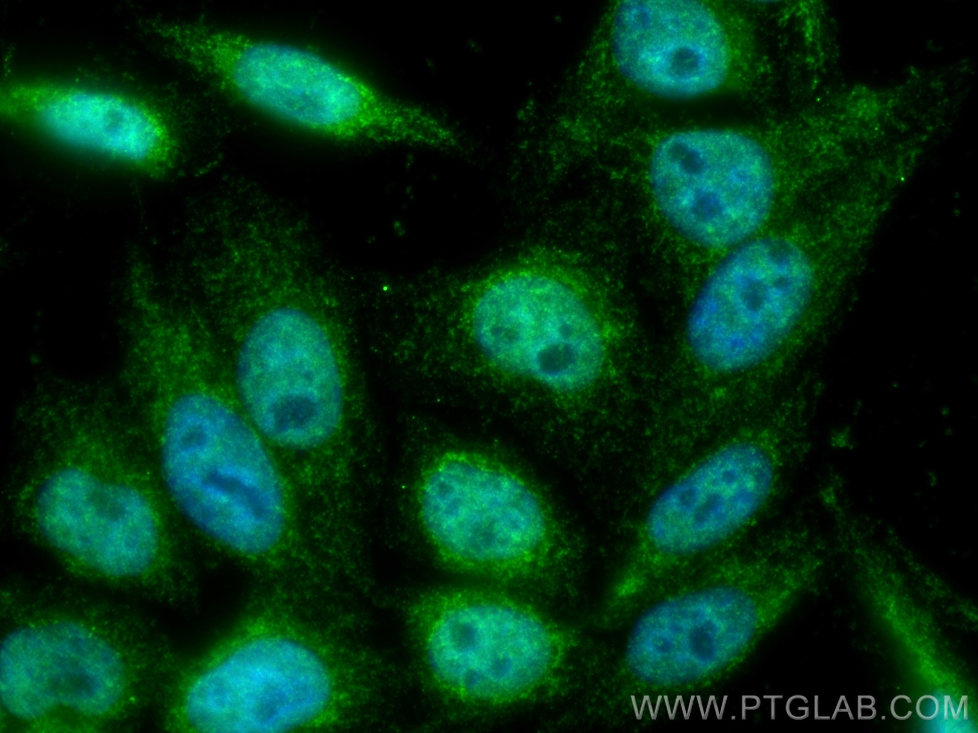 Immunofluorescence (IF) / fluorescent staining of HepG2 cells using IRF5 Polyclonal antibody (10547-1-AP)