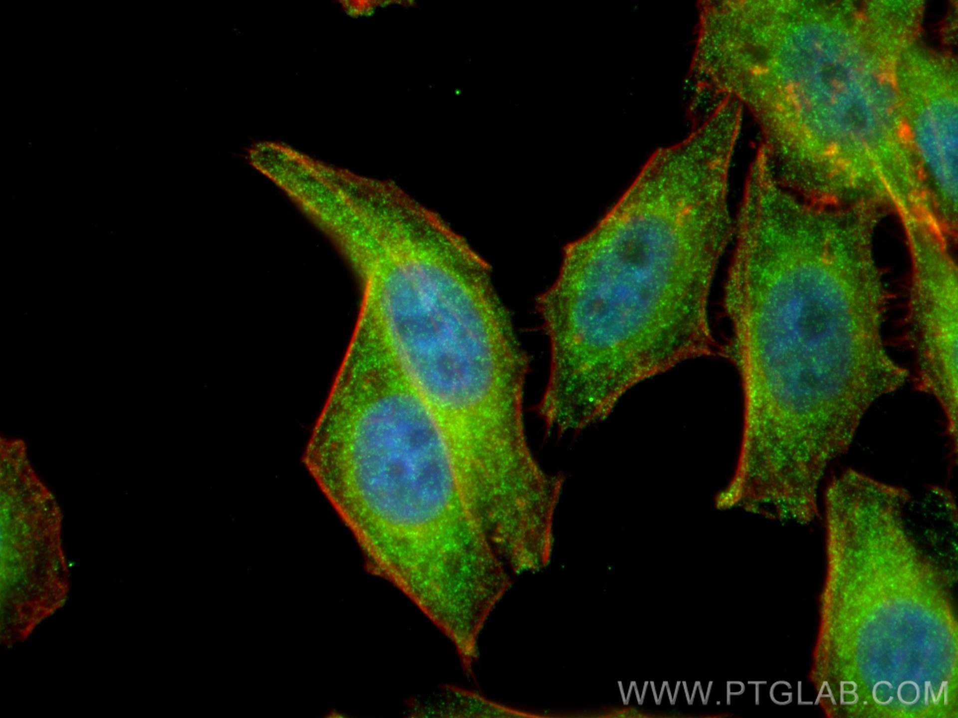 Immunofluorescence (IF) / fluorescent staining of HepG2 cells using IRF5 Polyclonal antibody (10547-1-AP)