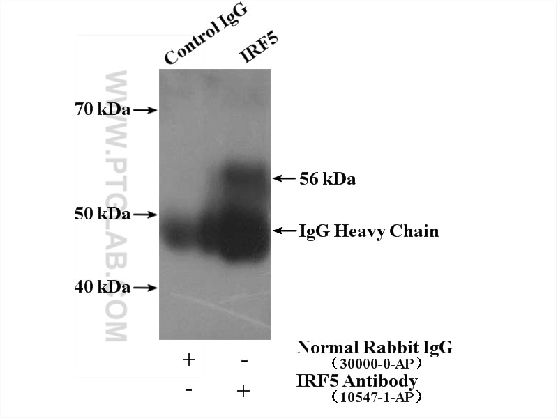 Immunoprecipitation (IP) experiment of HeLa cells using IRF5 Polyclonal antibody (10547-1-AP)