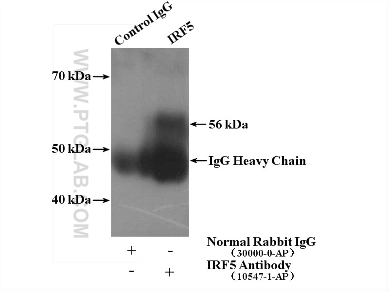 IP experiment of HeLa using 10547-1-AP