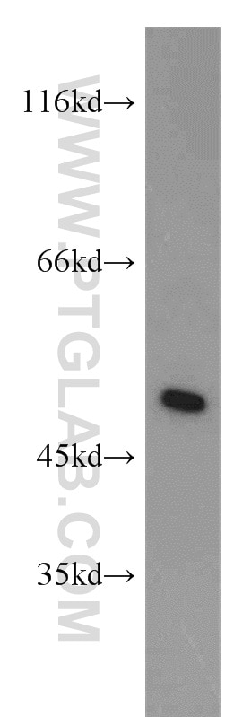 Western Blot (WB) analysis of Jurkat cells using IRF5 Polyclonal antibody (10547-1-AP)