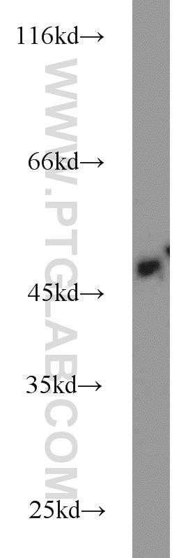 Western Blot (WB) analysis of Jurkat cells using IRF5 Polyclonal antibody (10547-1-AP)