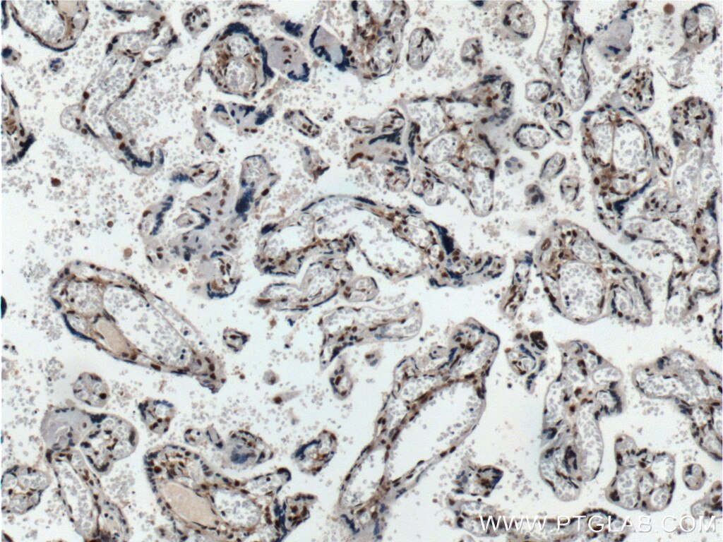 Immunohistochemistry (IHC) staining of human placenta tissue using IRF5 Monoclonal antibody (60088-1-Ig)