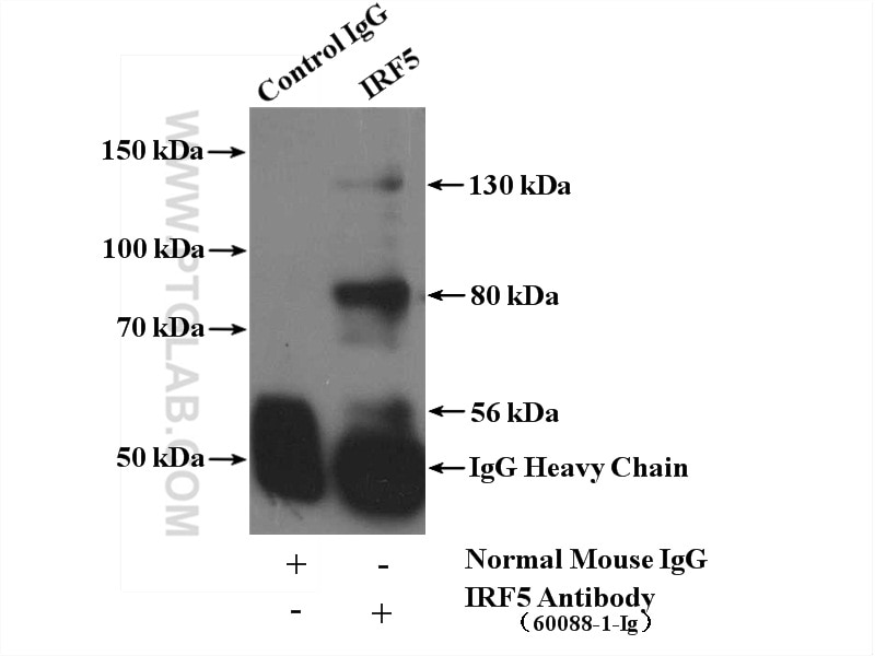 Immunoprecipitation (IP) experiment of HeLa cells using IRF5 Monoclonal antibody (60088-1-Ig)