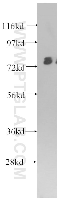 Western Blot (WB) analysis of HepG2 cells using IRF5 Monoclonal antibody (60088-1-Ig)