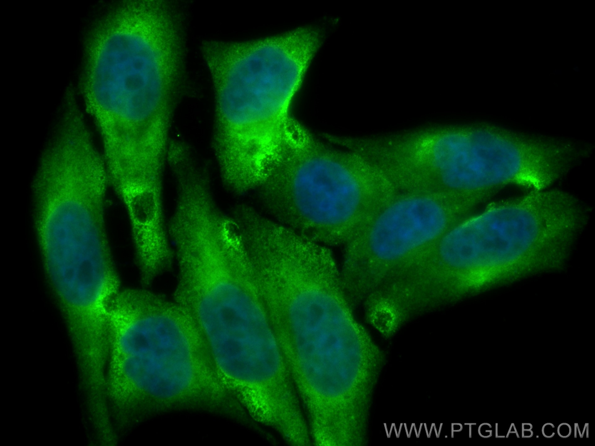 Immunofluorescence (IF) / fluorescent staining of HepG2 cells using CoraLite® Plus 488-conjugated IRF5 Monoclonal anti (CL488-66835)