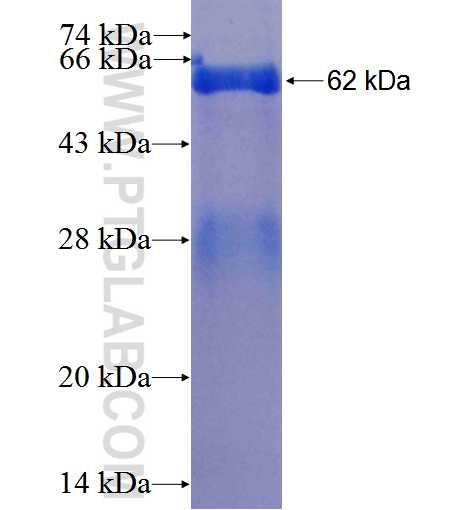 IRF5 fusion protein Ag0841 SDS-PAGE